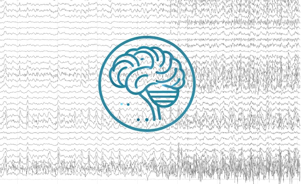 Ateliers EEG : pédiatrie et sommeil