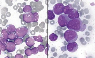 Swiss Molecular Hematology Society : Annual Technicians’ Meeting